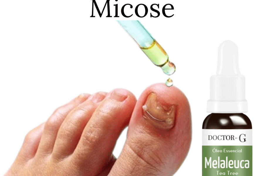 Oleo Essencial Melaleuca 100% Puro Australiano Tea Tree 15ML- DOCTOR-G