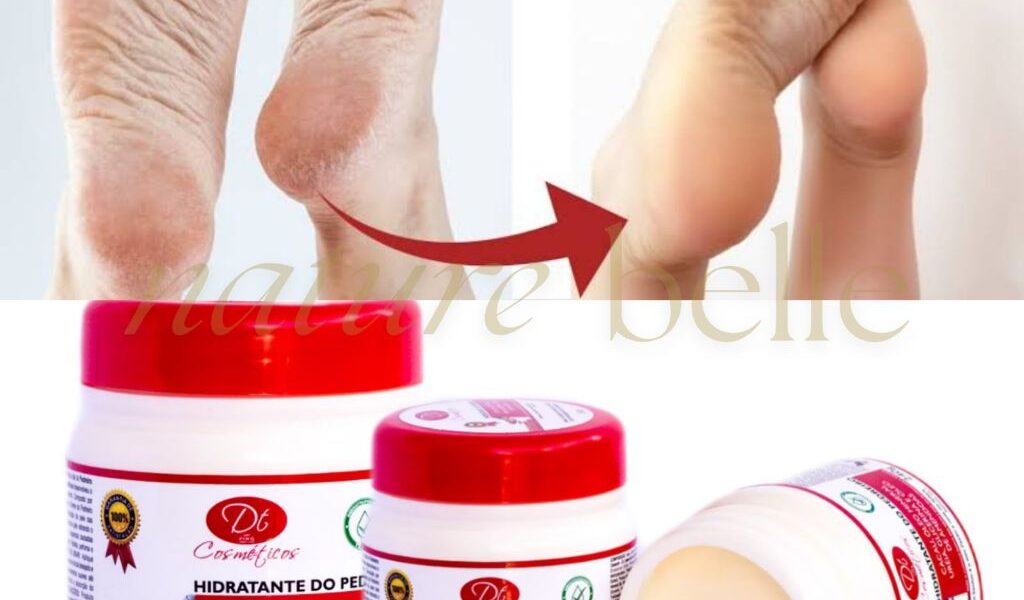 Creme Hidratante De Uréia 240g Creme De Pedreiro Pés Rachados E Ressecados Cacau Amendoas Glicerina